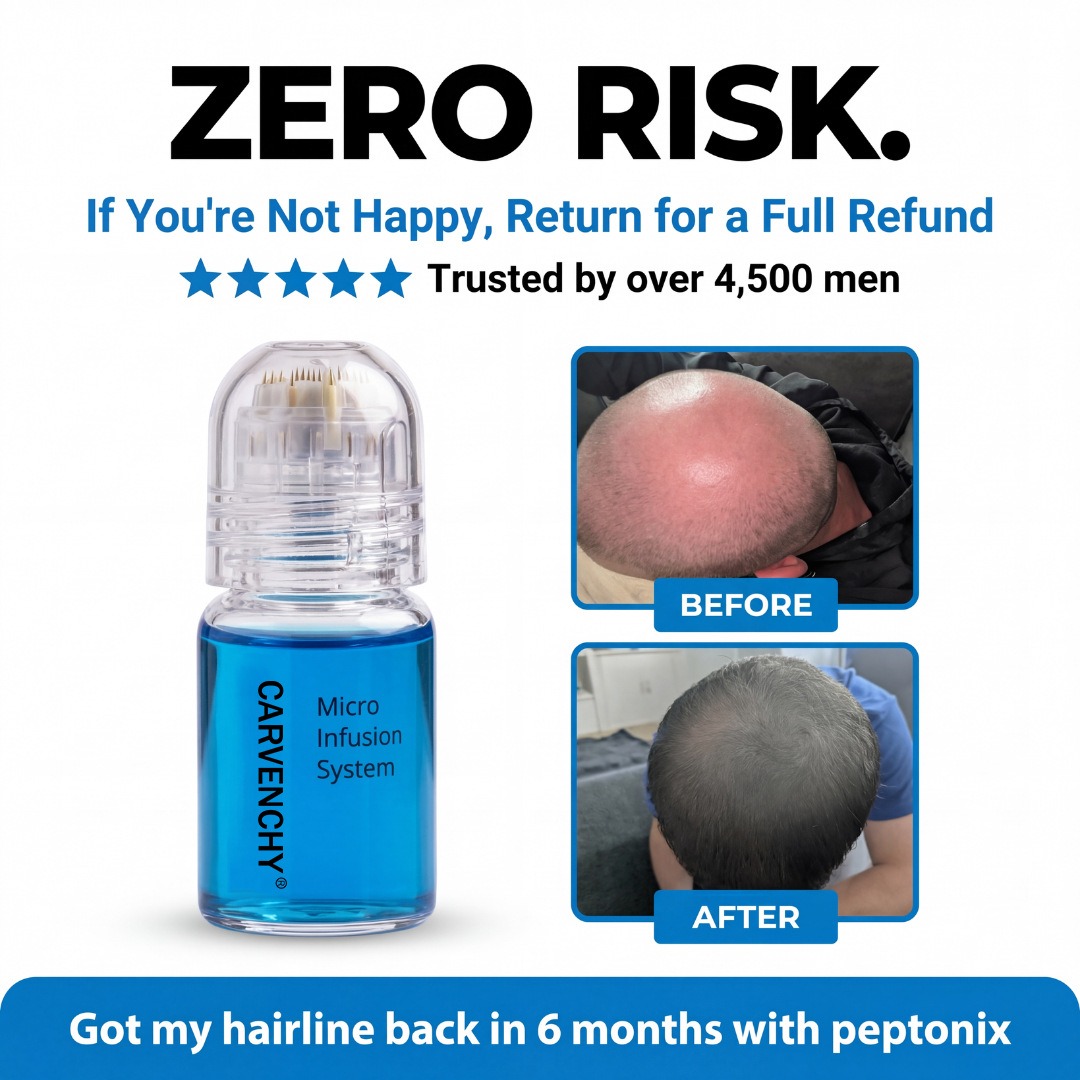 Hair Regrowth Microneedling GH - đánh giá và giá Peptide Complex Serum