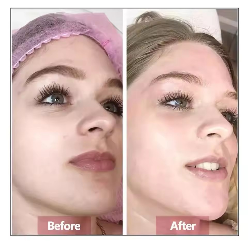 Black Rose Luxury Anti-Wrinkle - đánh giá và giá Luxury Skincare Serum